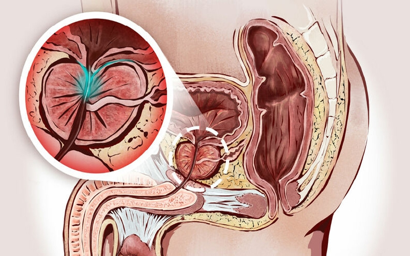 Urologia